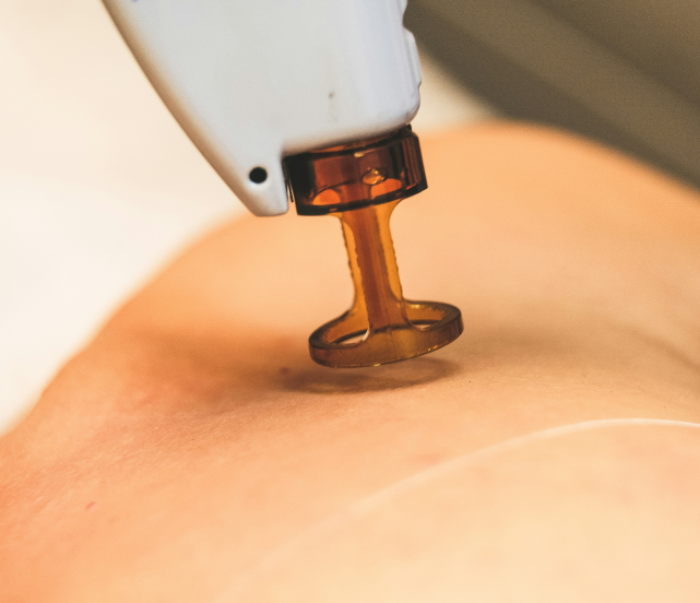 skin check